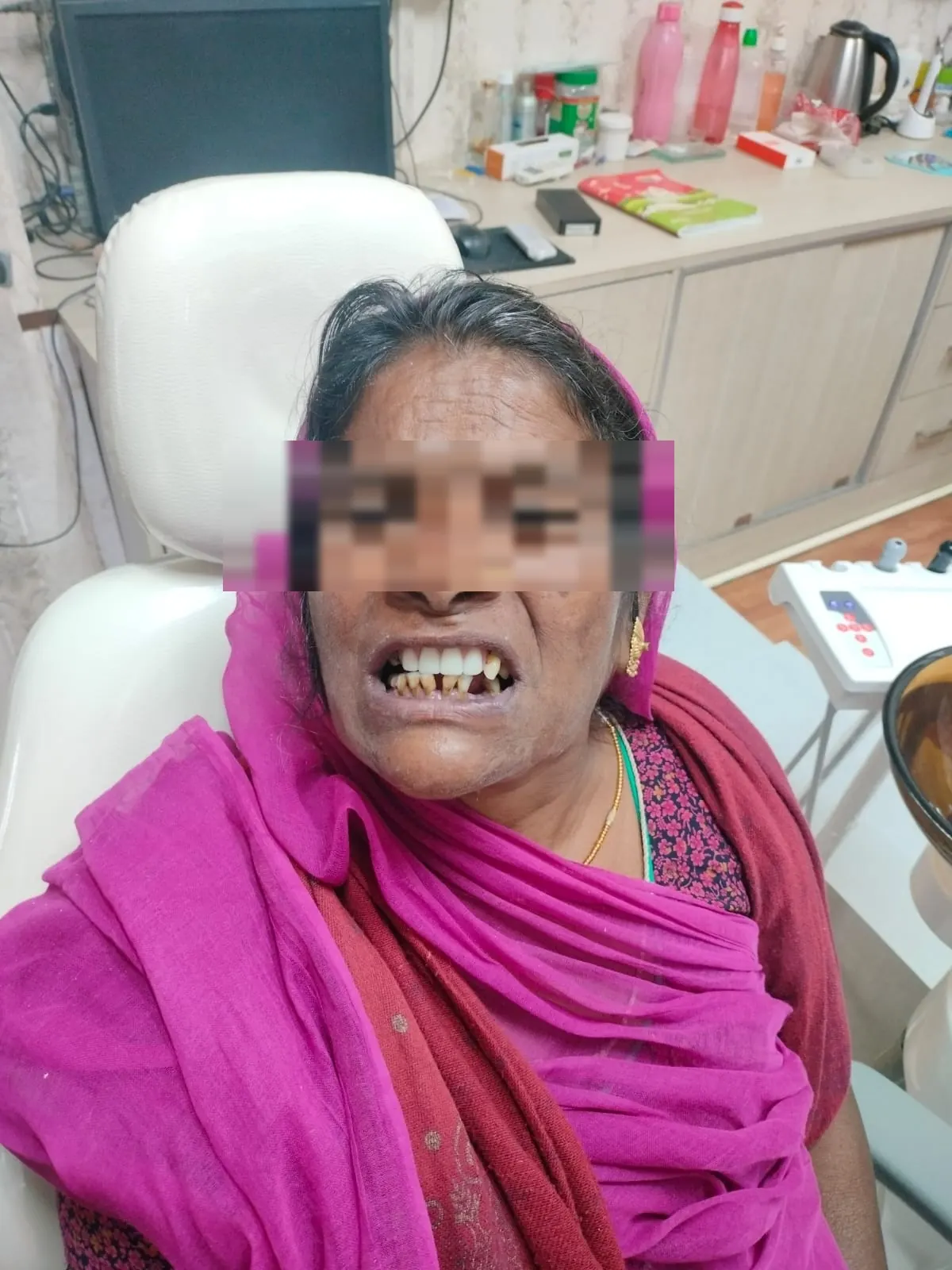 Checking tooth alignment during a consultation at MS Udaipur Dental Clinic